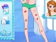 ألعاب طبيب بنات علاج القدمين